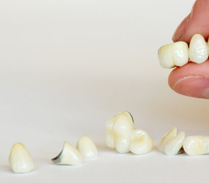 Why Porcelain Crowns are the Preferred Choice for Restoring Teeth