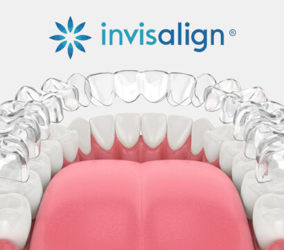 How Invisalign Improves Oral Health Along with Your Smile