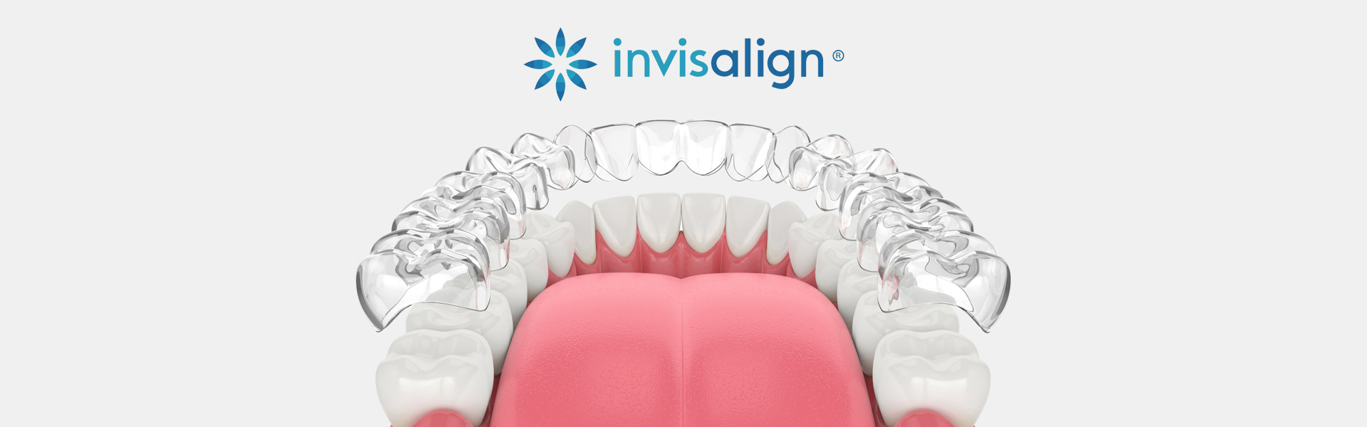 How Invisalign Improves Oral Health Along with Your Smile