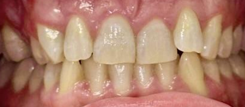 Before