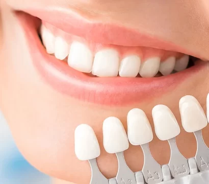 What Problems Can Porcelain Veneers Fix? A Detailed Guide